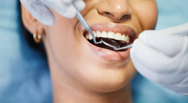 Best Emergency Root Canal Treatment in New Vienna, OH