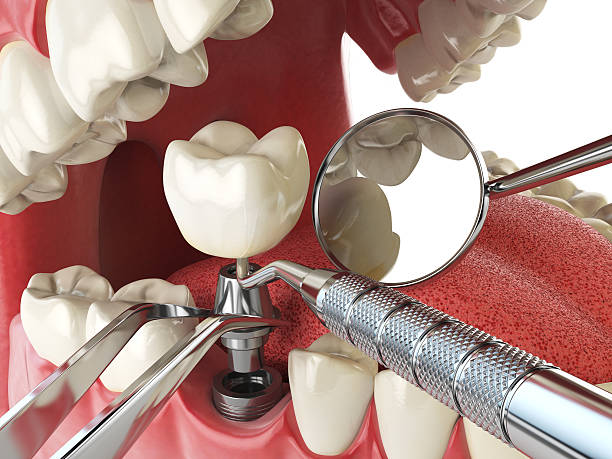 Best Orthodontic Emergency Dentist in New Vienna, OH